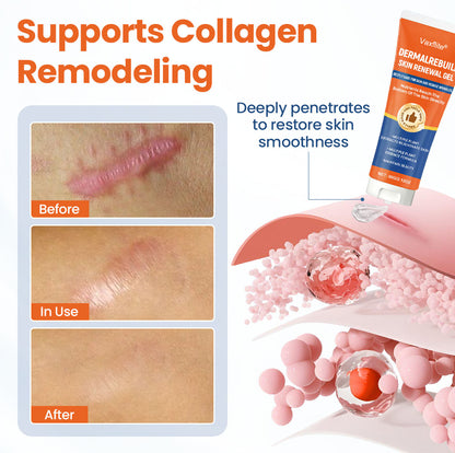 Vaxflite® DermalRebuild Skin Renewal Gel
