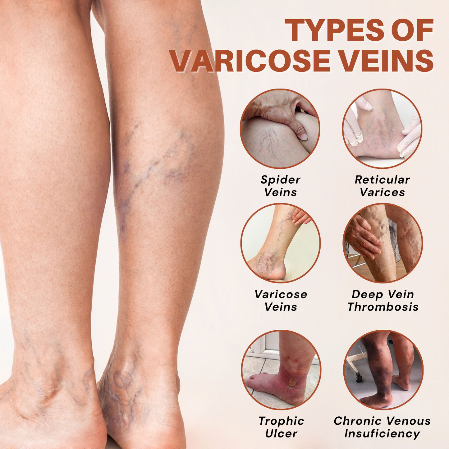 Vein Target Microneedle Patch