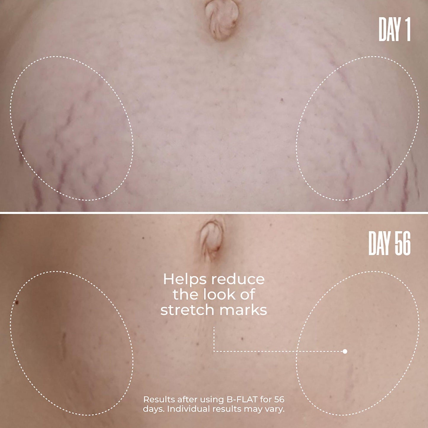 Tighten & Smooth Belly Cream