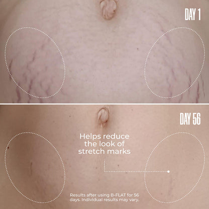 Tighten & Smooth Belly Cream