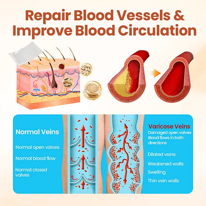 Vein Target Microneedle Patch